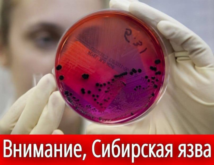 Сибирская язва – особо опасная инфекционная болезнь животных и человека!. Сибирская язва – особо опасная инфекционная болезнь животных и человека!.